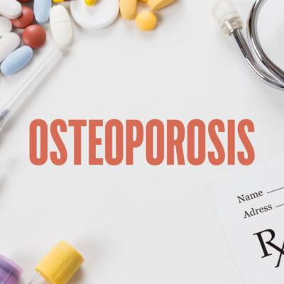 5 Early Symptoms of Osteoporosis