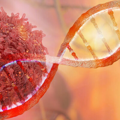 5 Questions Answered About Cancer and Genetics