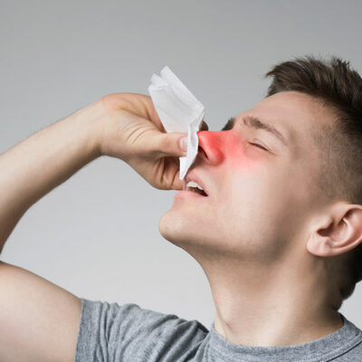 Early and Advanced Signs of Nasal Polyps