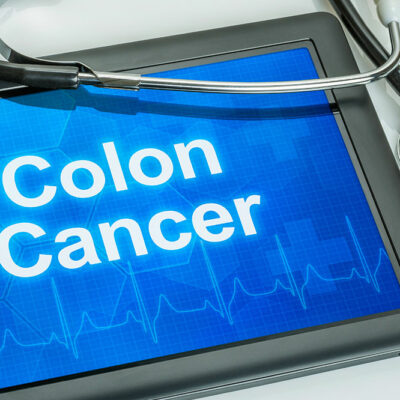 Risk Factors and Diagnostic Tools for Diagnosing Colon Cancer