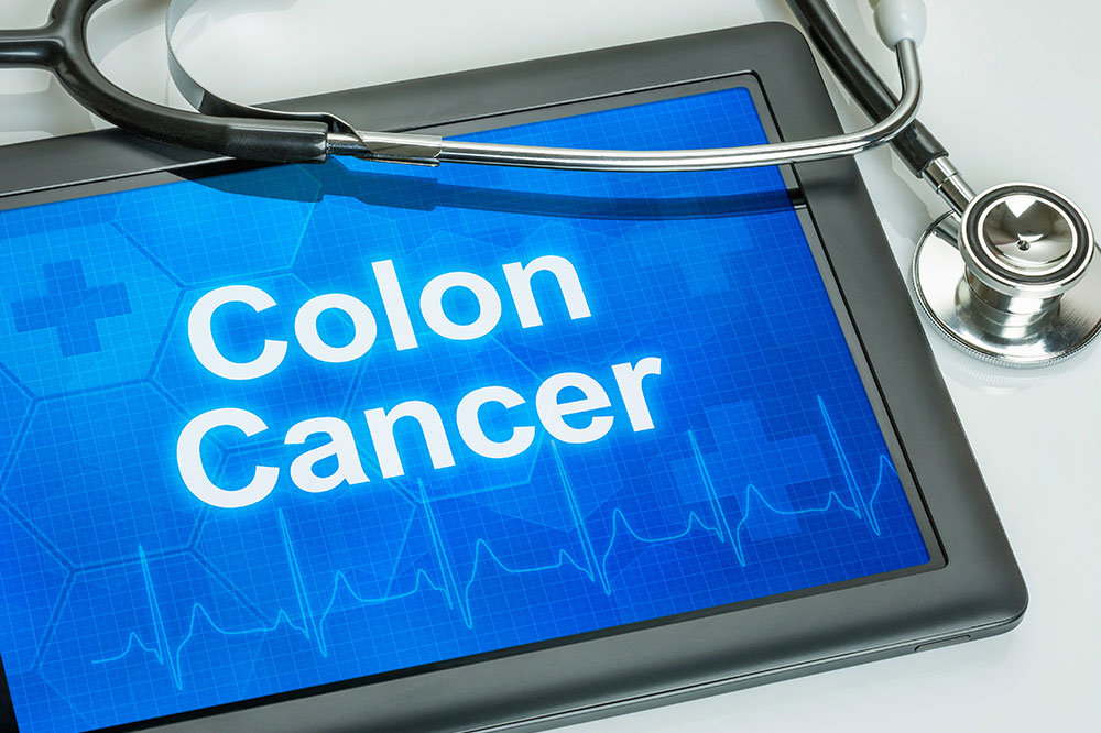 Risk Factors and Diagnostic Tools for Diagnosing Colon Cancer