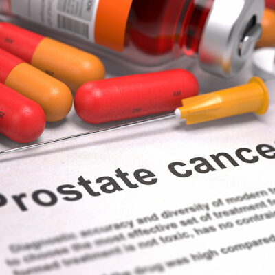 Treatment Options for Prostate Cancer