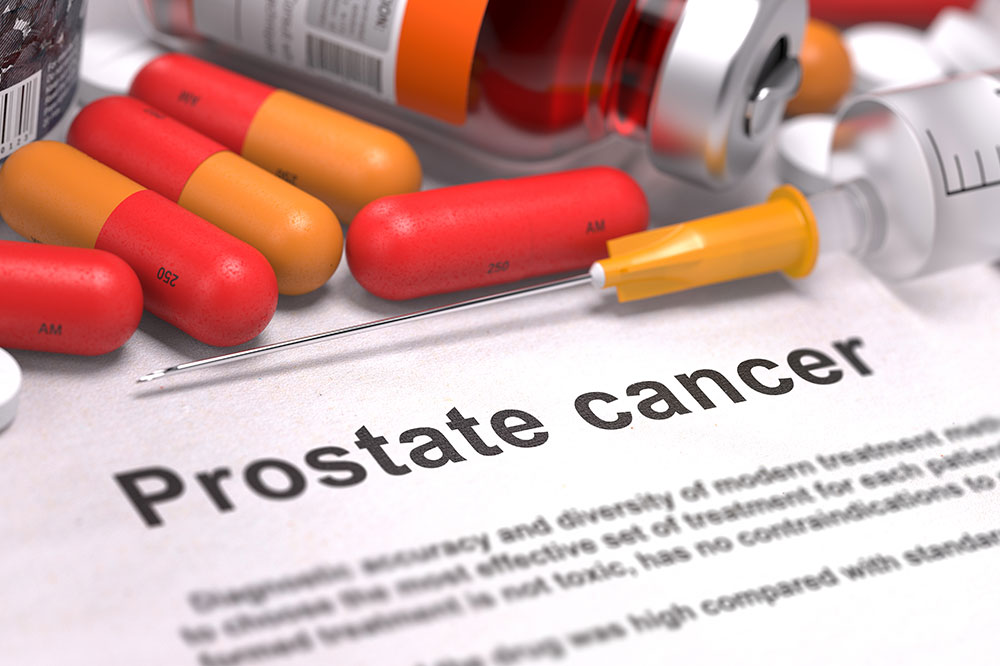 Treatment Options for Prostate Cancer