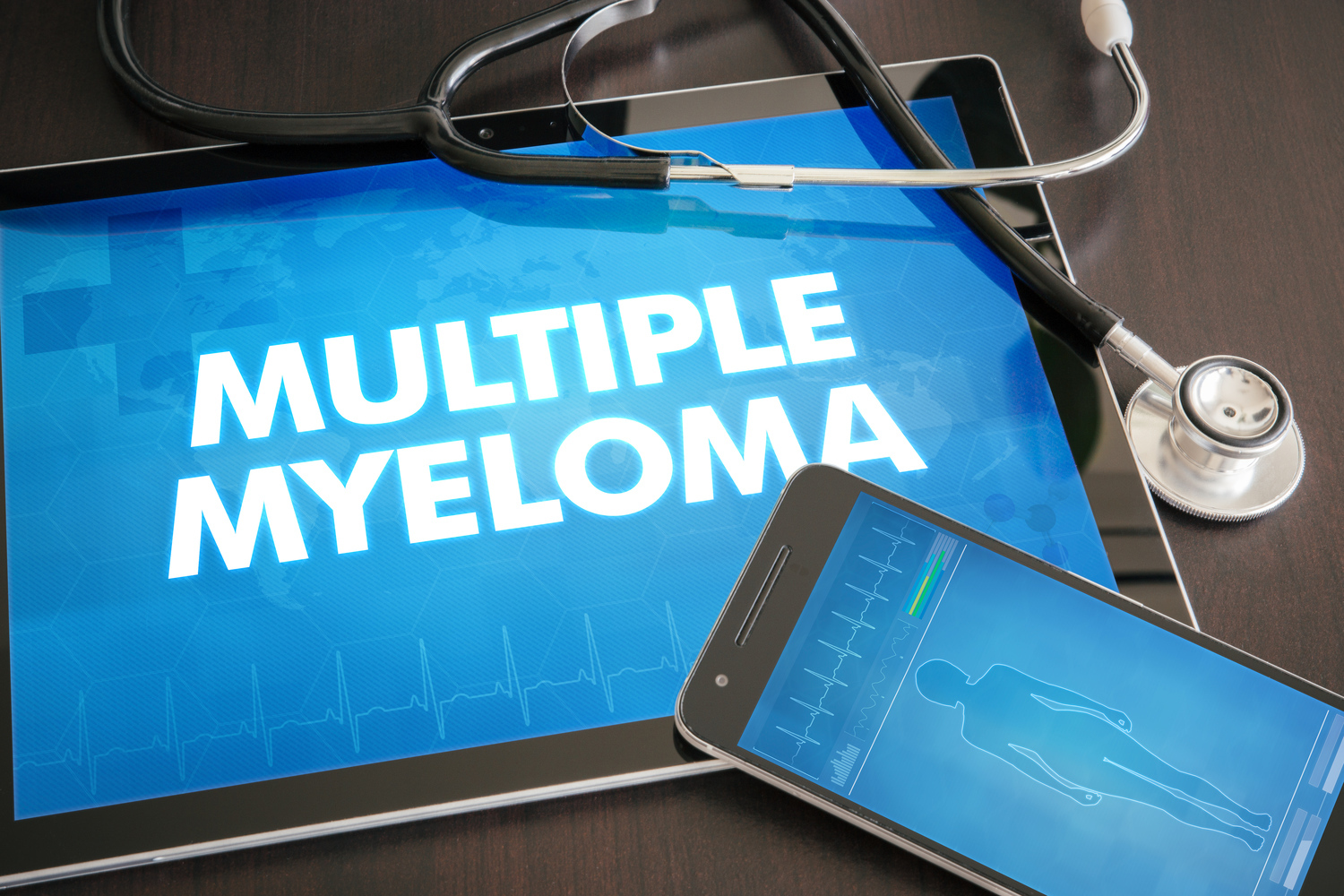 Early Warning Signs of Multiple Myeloma